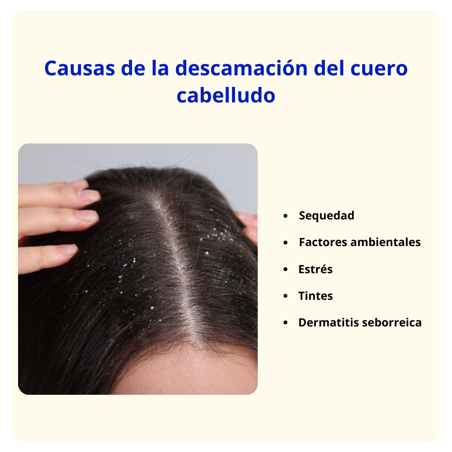 Causas de la descamación del cuero cabelludo