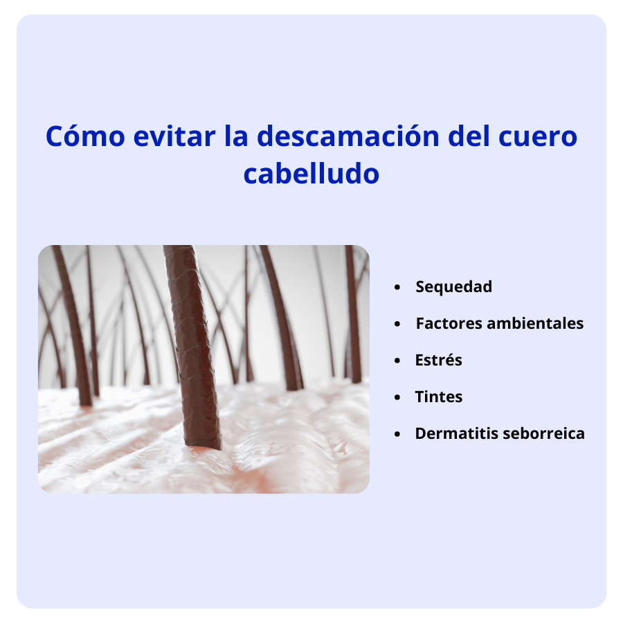 Causas de la descamación del cuero cabelludo