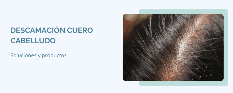 Soluciones efectivas para la descamación del cuero cabelludo